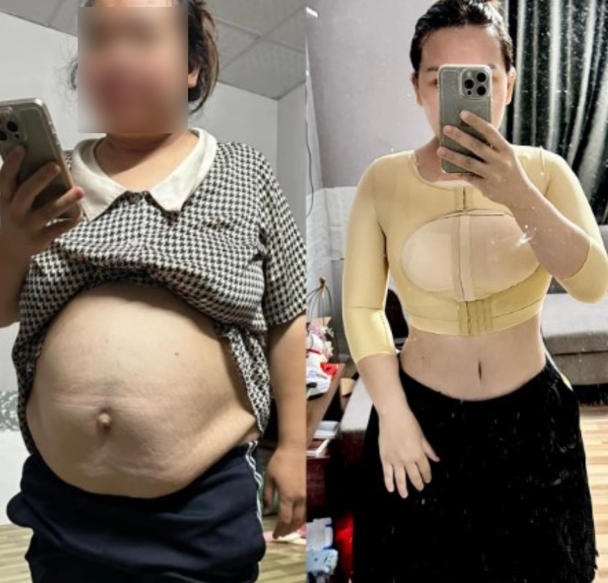 Viên nang hủy mỡ TuThen lấy lại dáng sau sinh cho mẹ bỉm